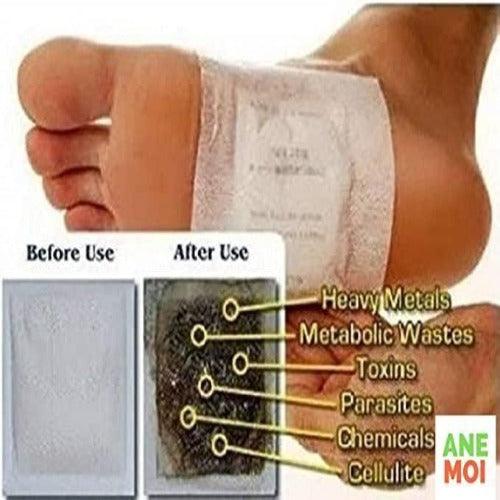 Detox Foot Patches (Set of 10) - Springkart 